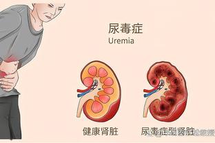 半场-国米1-0领先尤文 巴雷拉造加蒂乌龙尤文半场0射正